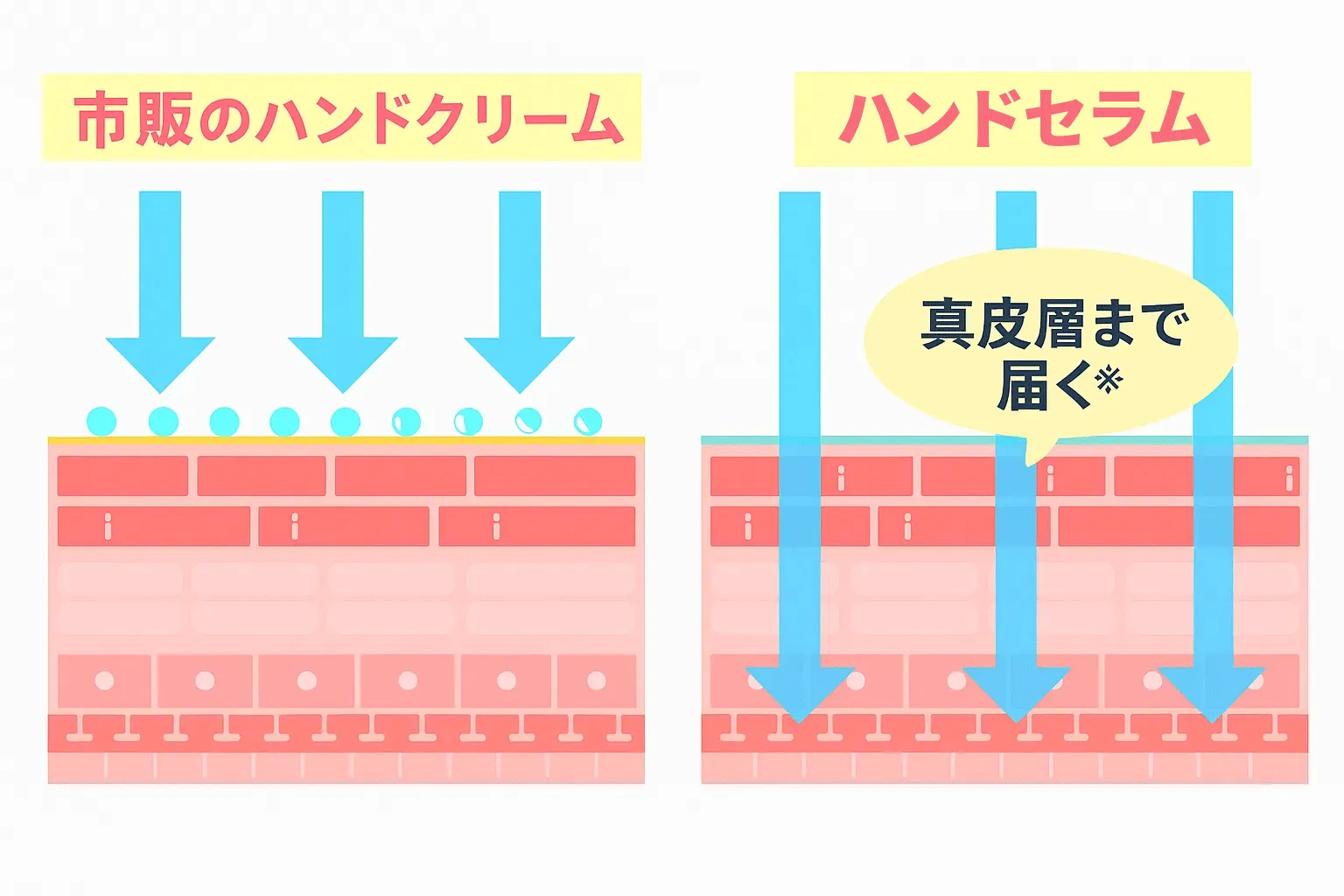 ハンドセラムなら真皮に届く