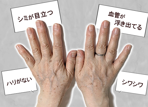 老け手