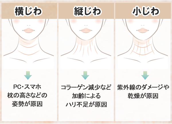 小じわ縦じわ横ジワ