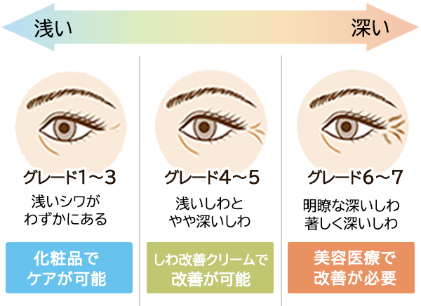 シワグレード